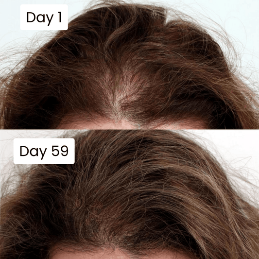 Scalp Hair Growth Serum